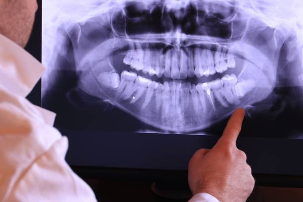 Best Emergency Dentist for Lost Fillings or Crowns in Homer, AK