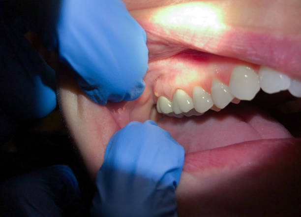 Best Broken or Cracked Tooth Emergency Dentist in Homer, AK