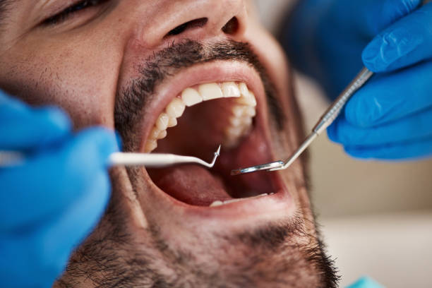 Best Emergency Dental Services for Seniors in Homer, AK
