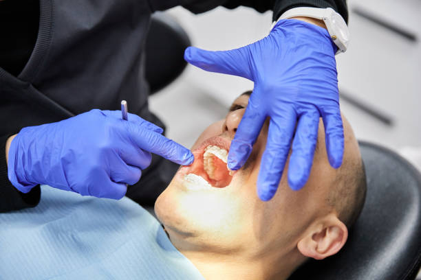 Best Emergency Dentist for Knocked-Out Tooth in Homer, AK